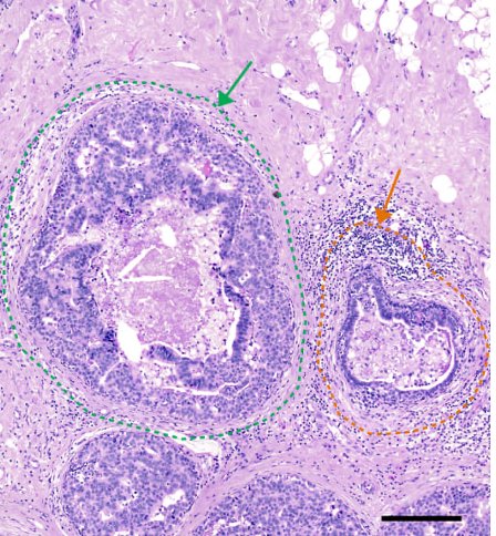 Conventional histology section (H&E stain)