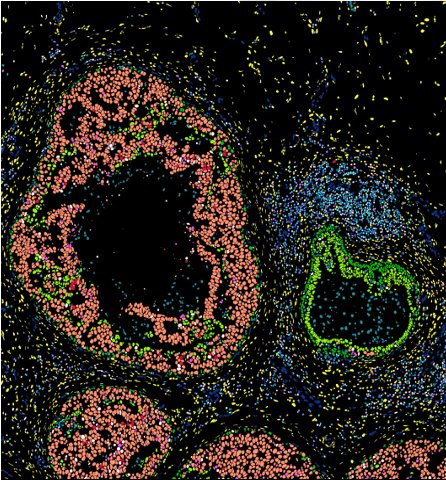 Spatial transcriptome fluorescence image